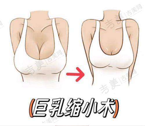 苏州奥美定取出好的医院排名榜——苏州妘芮医疗美容诊所
