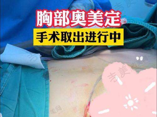 苏州奥美定取出好的医院排名榜——苏州圣爱医院整形美容科