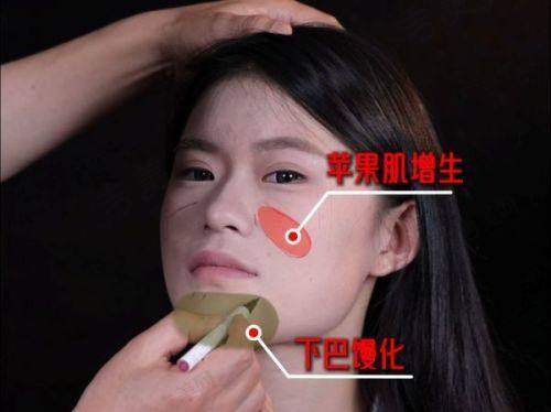 湖南省人民医院整形美容科取奥美定特色