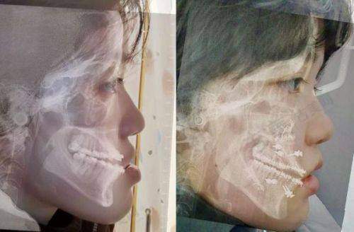 王旭明医生手术价格情况:合理收费物有所值