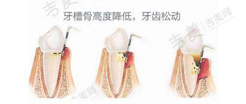 中南大学湘雅三医院取奥美定经验与收费