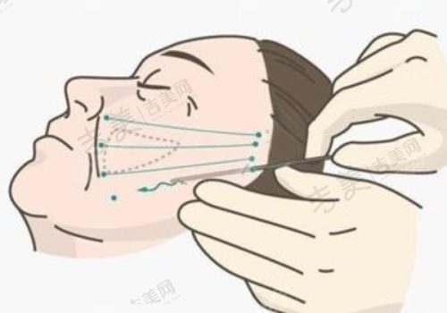 王旭明医生鼻子手术技术优势:独特技术打造自然美鼻