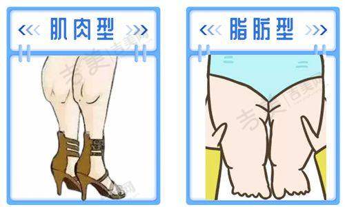 长沙艺脂医疗美容门诊取奥美定技术前列