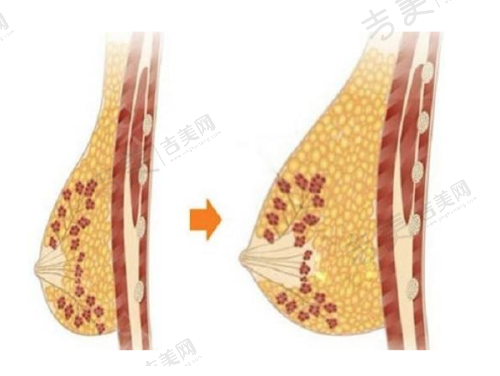长沙伊美整形门诊部取奥美定套餐优势