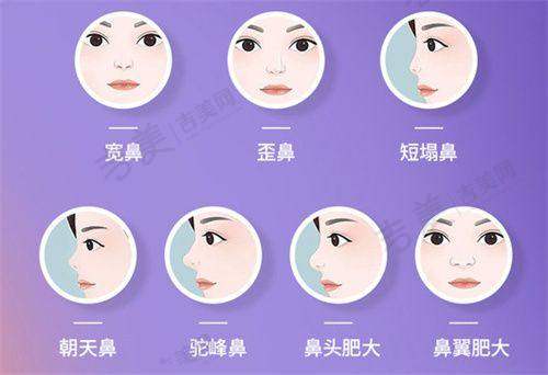 沈阳杏林整形预约挂号详情