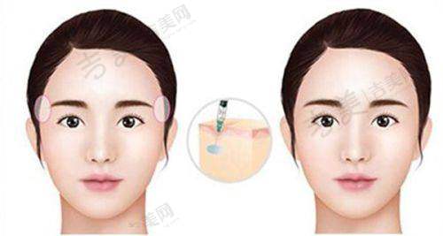 长沙珀斐医疗美容门诊部取奥美定价格与技术