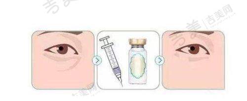 王旭明医生年龄优势:沉稳经验应对复杂问题