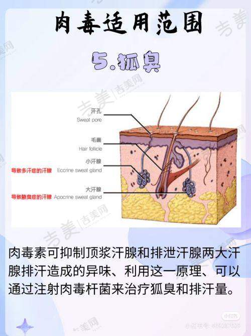 热门医美项目介绍