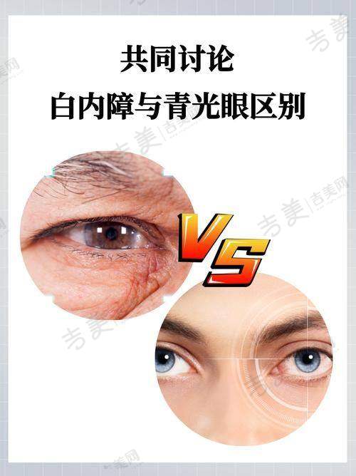 江门爱尔眼科医院价格表