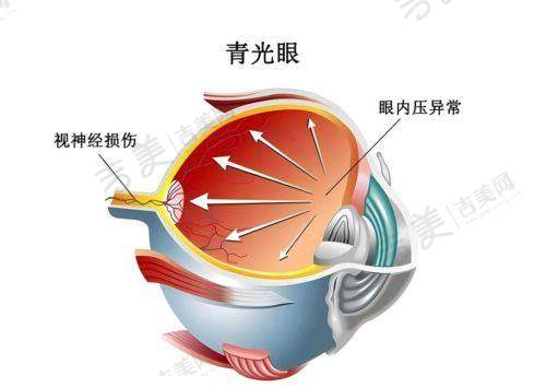 四、慈溪爱尔眼科医院项目特色解析