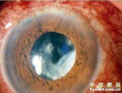 五、慈溪爱尔眼科医院医生团队介绍