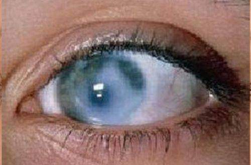 奉化爱尔光明眼科医院医生简介