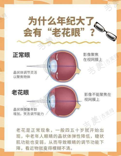 奉化爱尔光明眼科医院项目特色