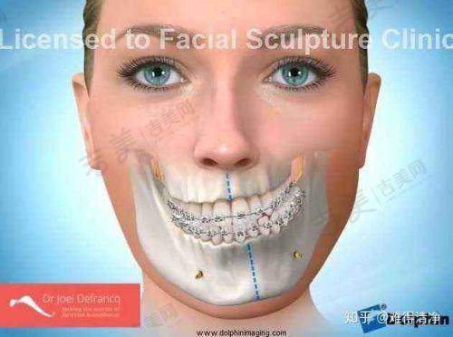 北京嘉禾医疗美容主推项目有哪些