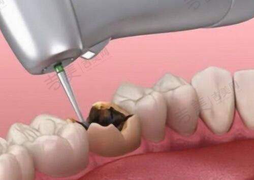 北京嘉禾整形医院的医疗保险政策是怎样的