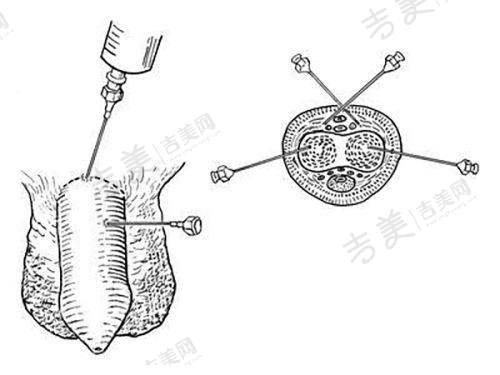 北京嘉禾整形的医生团队强大吗