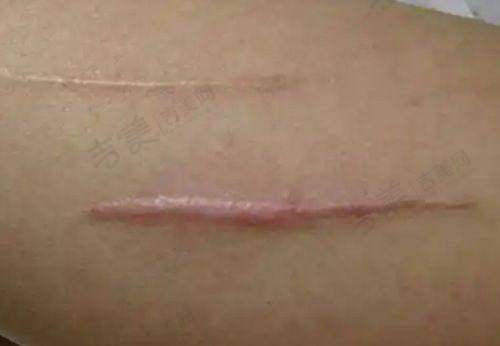 北京嘉禾整形私密整形靠谱吗