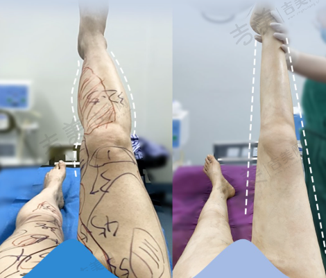 北京嘉禾整形注射和抗衰项目有优势吗