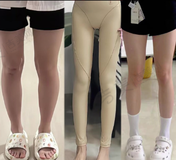 北京嘉禾整形擅长眼部整形吗