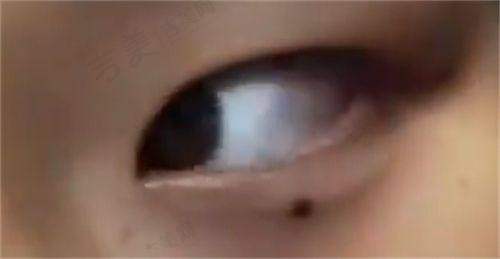 北京嘉禾整形收费价格表影响因素