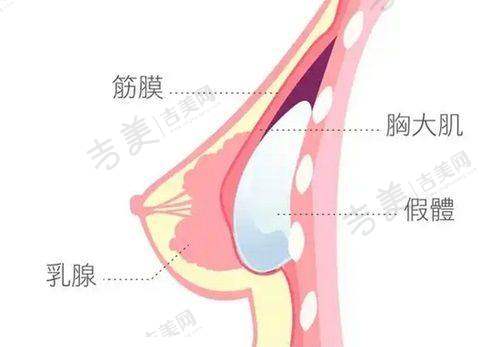 北京嘉禾整形主推项目有哪些