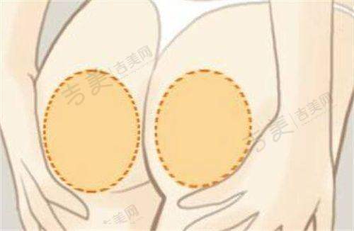 北京嘉禾整形医院收费情况如何