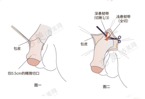 北京嘉禾整形的医疗保险政策是怎样的