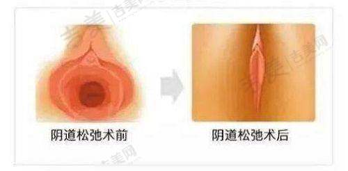 北京嘉禾整形收费价格表与市场对比