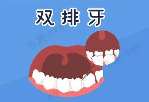 周东旭医生挂号预约方式