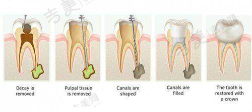 五、张琳医生实例——成功解决口腔问题的见证
