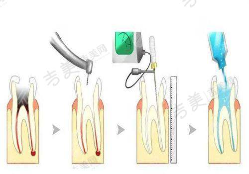 李孟奇医生收费价格