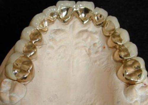 黄海花医生手术费用详情