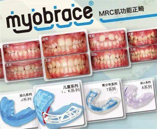 杨建医生手术费用