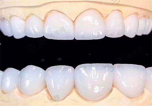 周东旭医生手术费用详情