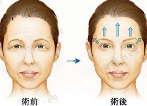 北京嘉禾整形的收费透明吗