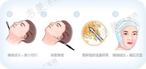 北京嘉禾整形收费价格表总结与建议