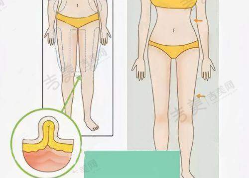 北京嘉禾整形医院的李燕院长擅长什么