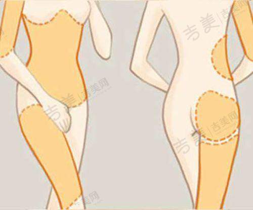 北京嘉禾整形医院的仪器抗衰项目怎么样