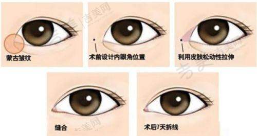 北京嘉禾整形收费价格表顾客好评