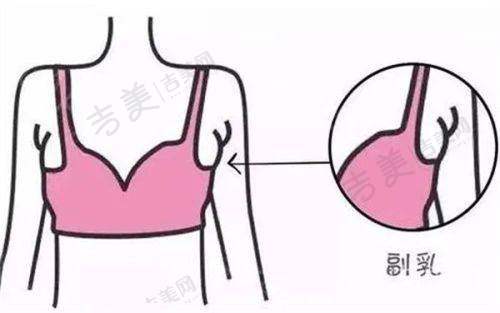 北京嘉禾整形医院的鼻部整形项目怎么样