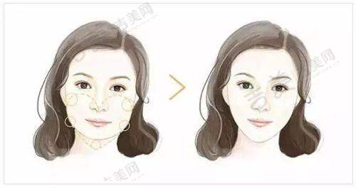 北京嘉禾整形的口碑如何