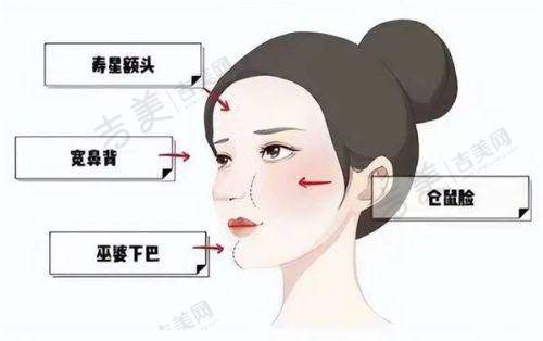 北京嘉禾整形医院的成单更多项目是哪些