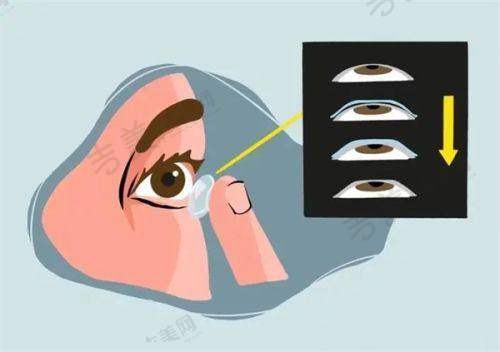 郑州医院白内障手术特色技术与优势