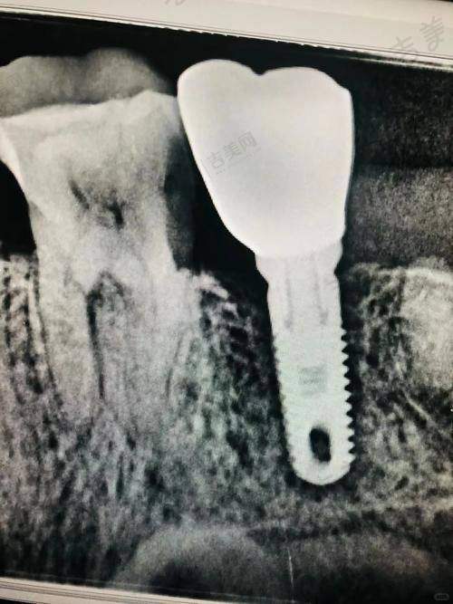 李孟奇医生预约挂号