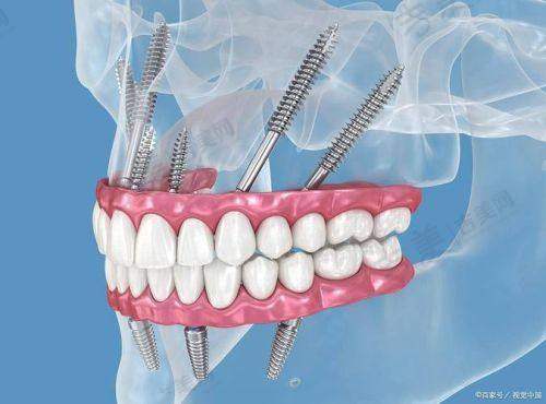 李孟奇医生顾客实例