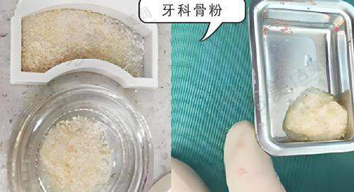 李孟奇医生口碑如何