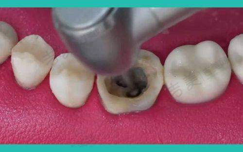 四、张琳医生口碑和评价——患者信赖的口腔医生