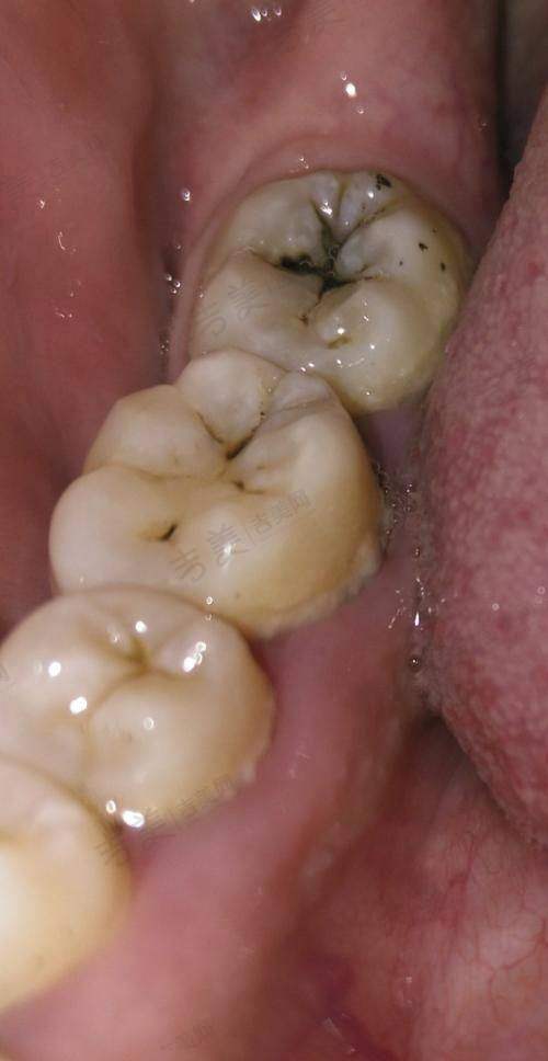 二、张琳医生简历——口腔医疗界的专精人才