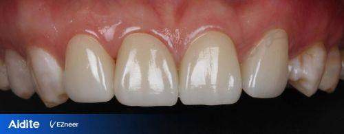 黄海花医生的真实评价如何