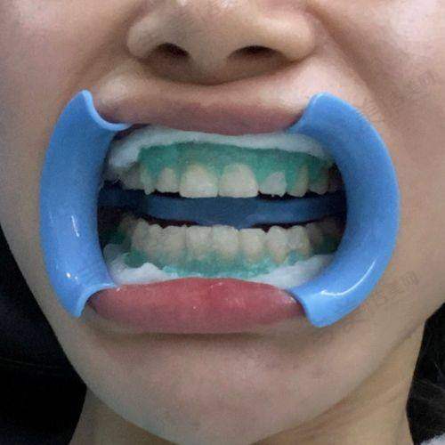 李孟奇医生属于什么级别